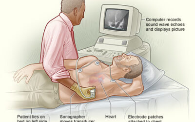 What is an Echocardiogram?